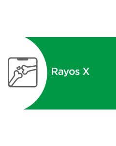 Rx de t&oacute;rax postero-anterior